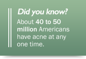 Treatment-Acne-affects-sensitive-skin-care-stats